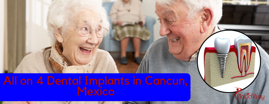 All on 4 Dental Implants in Cancun, Mexico